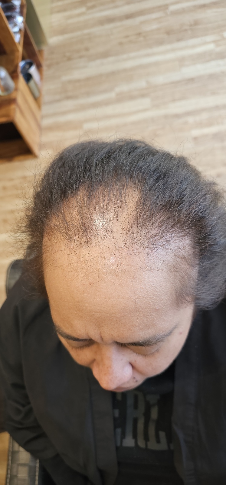 https://www.perthmeshhairintegration.com.au/wp-content/uploads/2024/09/20240622_122422.jpg