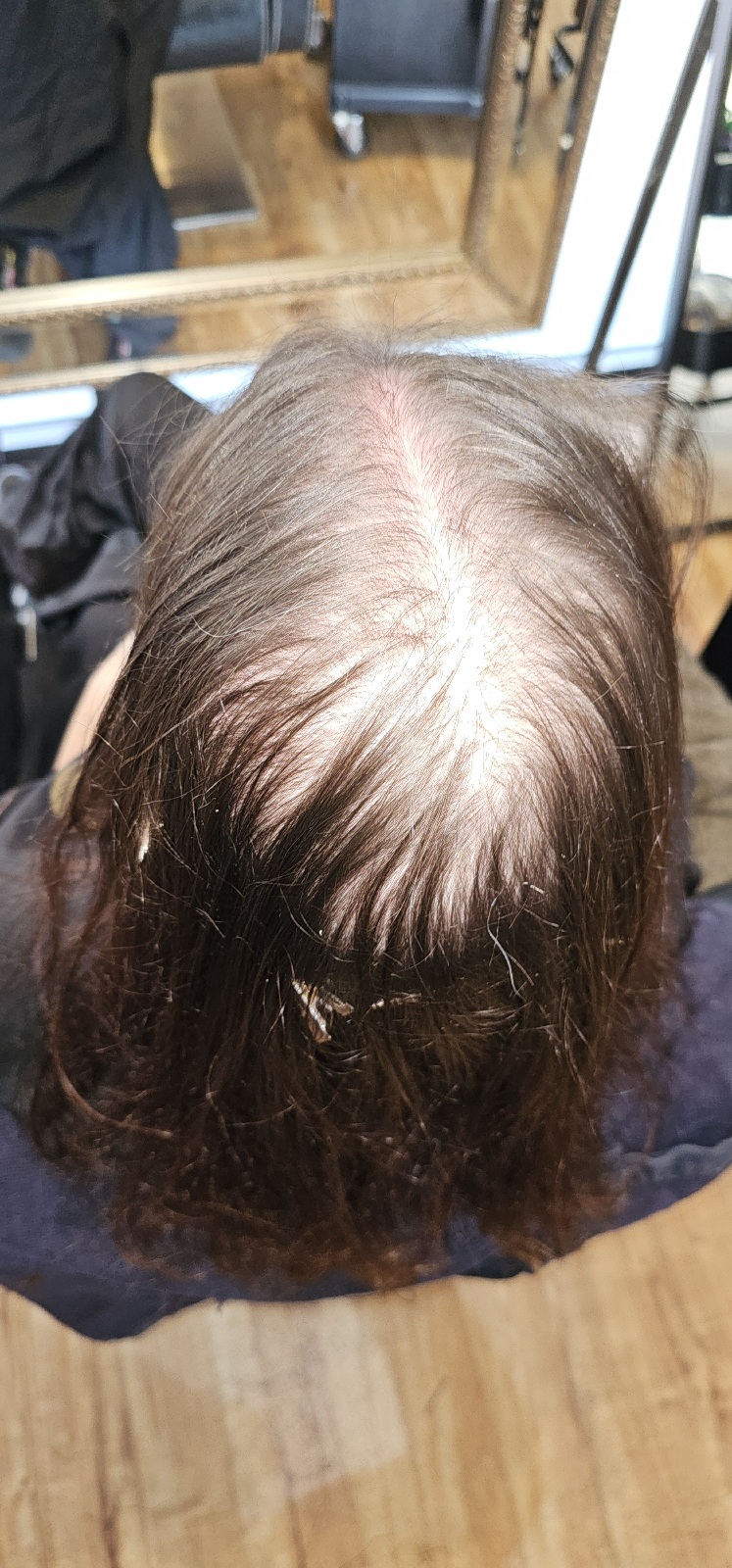 https://www.perthmeshhairintegration.com.au/wp-content/uploads/2024/09/20240821_123932.jpg